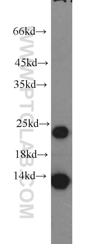 Western Blot (WB) analysis of human skeletal muscle tissue using MYL1 Polyclonal antibody (15814-1-AP)