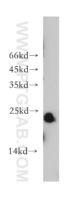 WB analysis of mouse heart using 15814-1-AP