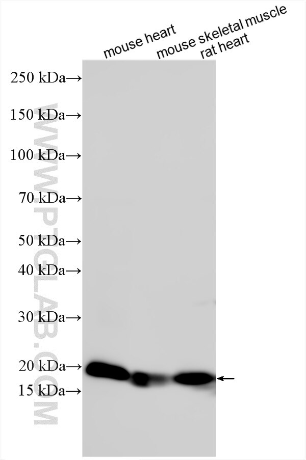 Various lysates were subjected to SDS PAGE followed by western blot with 15396-1-AP (MYL10 antibody) at dilution of 1:10000 incubated at room temperature for 1.5 hours. Western Blot (WB) analysis of various lysates using MYL10 Polyclonal antibody (15396-1-AP)