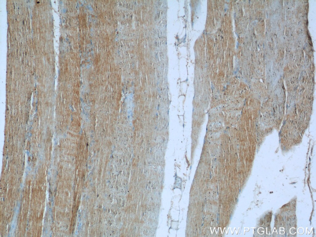 IHC staining of human skeletal muscle using 16287-1-AP