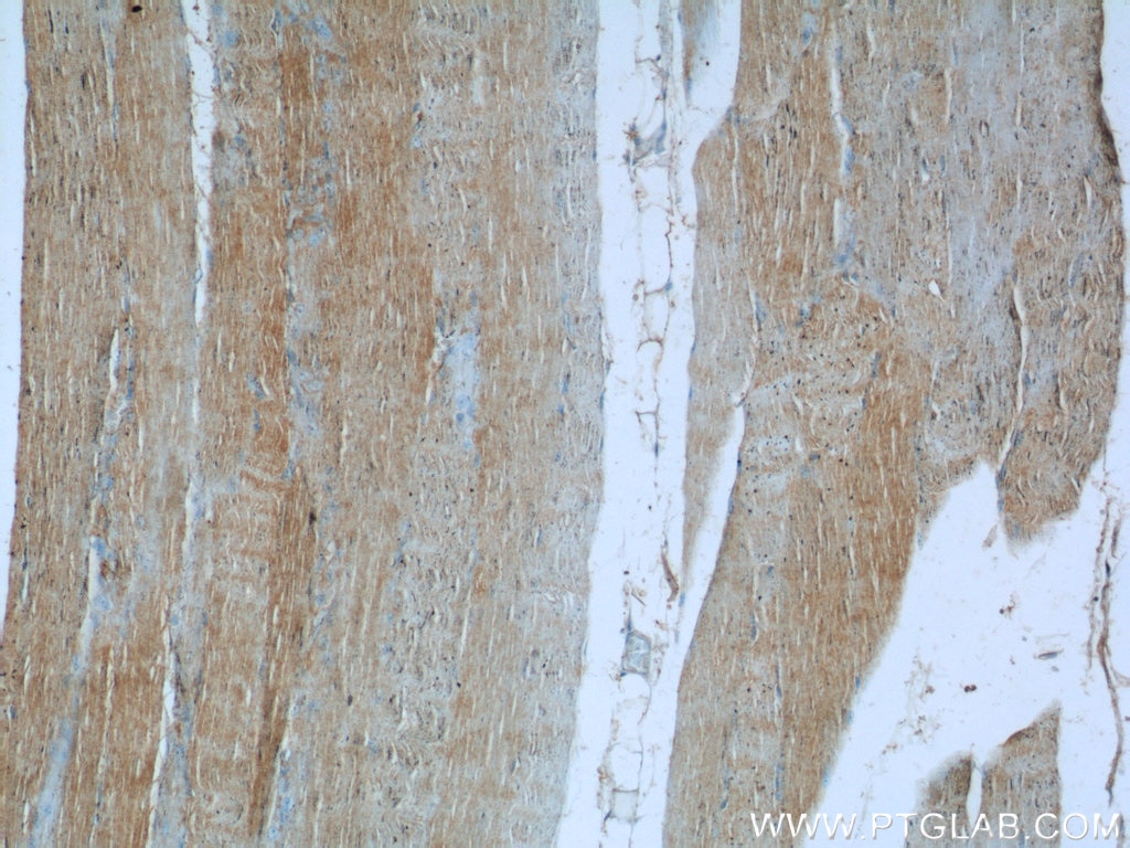 IHC staining of human skeletal muscle using 16287-1-AP