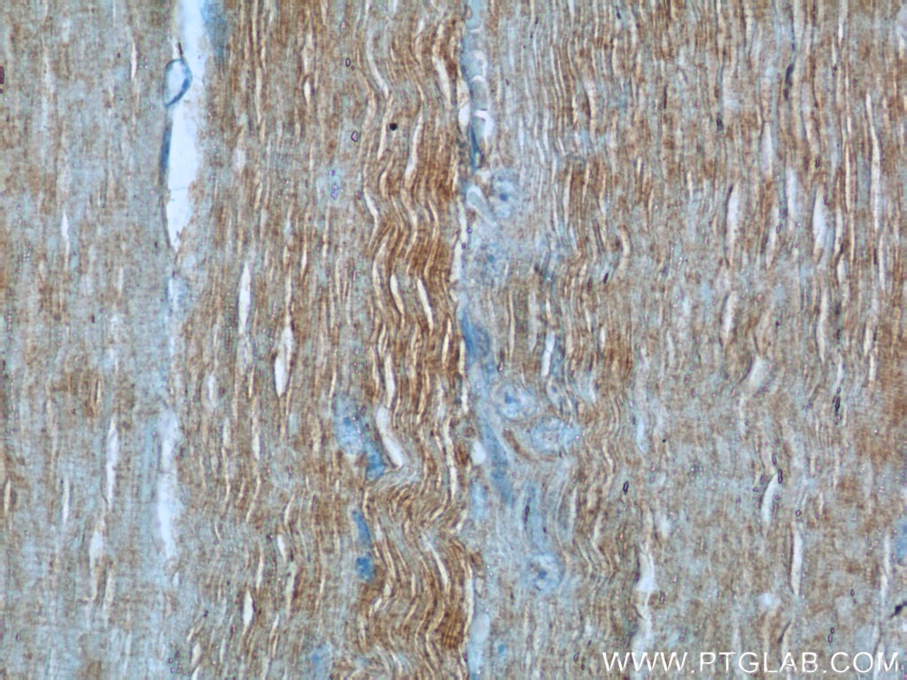 Immunohistochemistry (IHC) staining of human skeletal muscle tissue using MYL12A Polyclonal antibody (16287-1-AP)