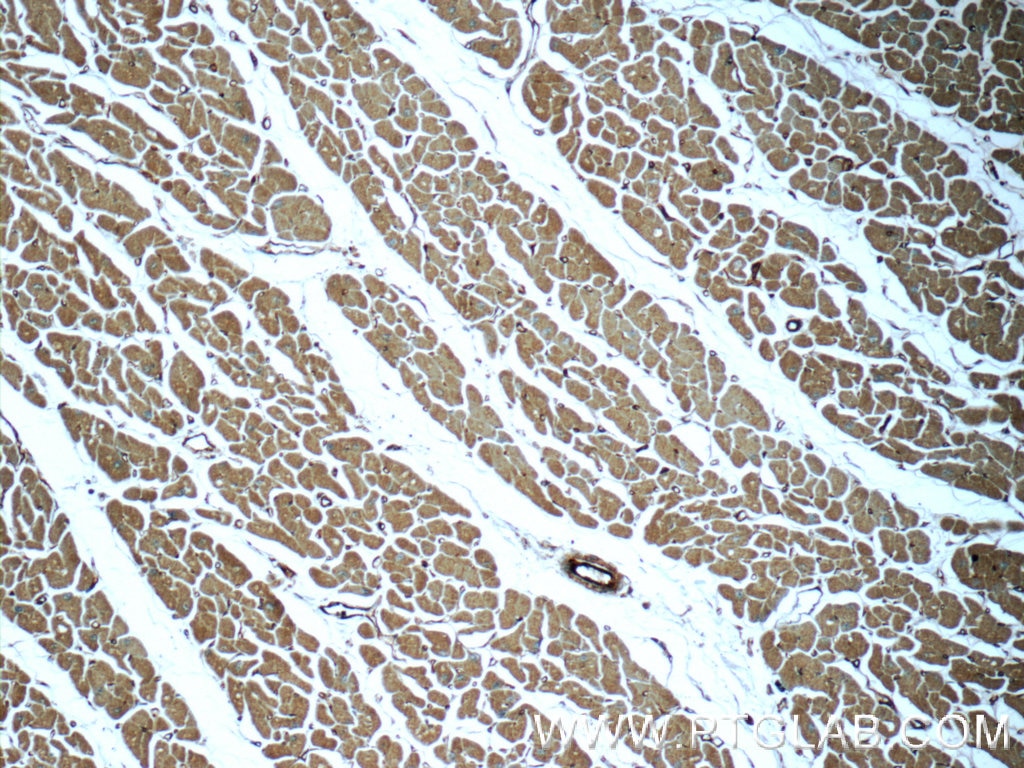 Immunohistochemistry (IHC) staining of human heart tissue using MYL12A Polyclonal antibody (16287-1-AP)
