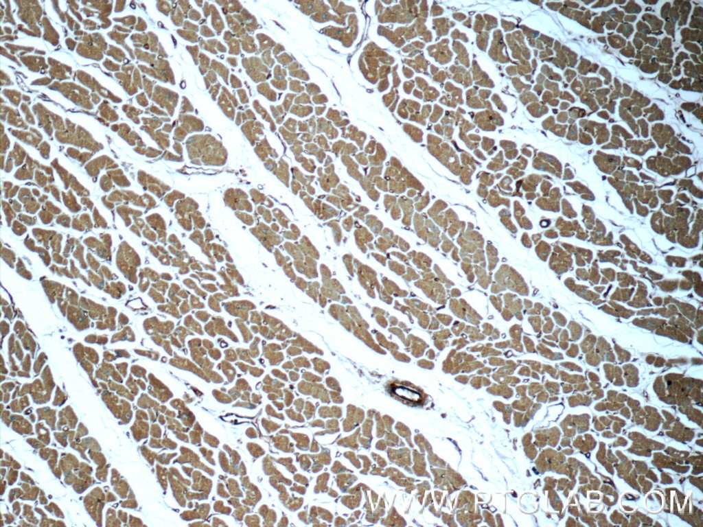 MYL12A Polyclonal antibody