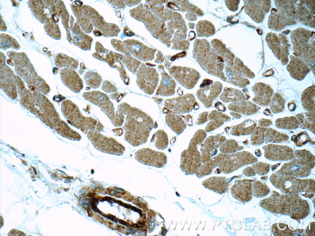 IHC staining of human heart using 16287-1-AP