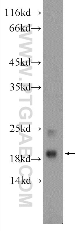 Western Blot (WB) analysis of HEK-293 cells using MYL12A Polyclonal antibody (16287-1-AP)