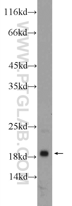 WB analysis of mouse heart using 16287-1-AP