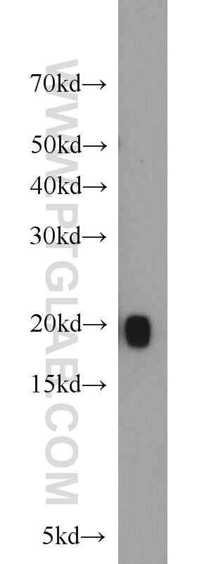 Western Blot (WB) analysis of human skeletal muscle tissue using MYL12A Polyclonal antibody (16287-1-AP)