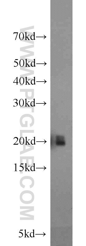 Western Blot (WB) analysis of mouse bladder tissue using MYL12A Polyclonal antibody (16287-1-AP)