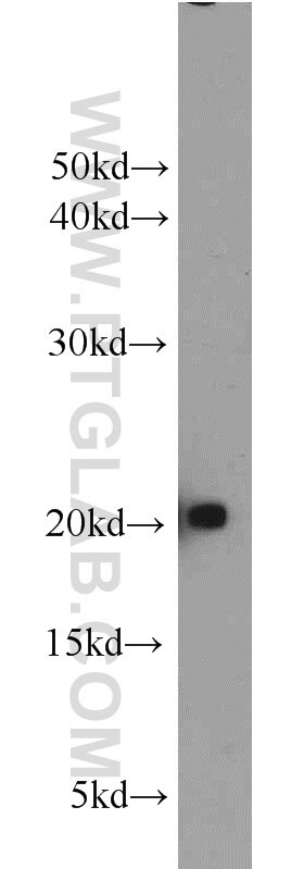 Western Blot (WB) analysis of Jurkat cells using MYL12A Polyclonal antibody (16287-1-AP)