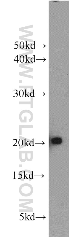 WB analysis of Jurkat using 16287-1-AP