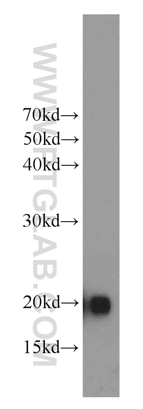 Western Blot (WB) analysis of mouse heart tissue using MYL12B Polyclonal antibody (10324-1-AP)