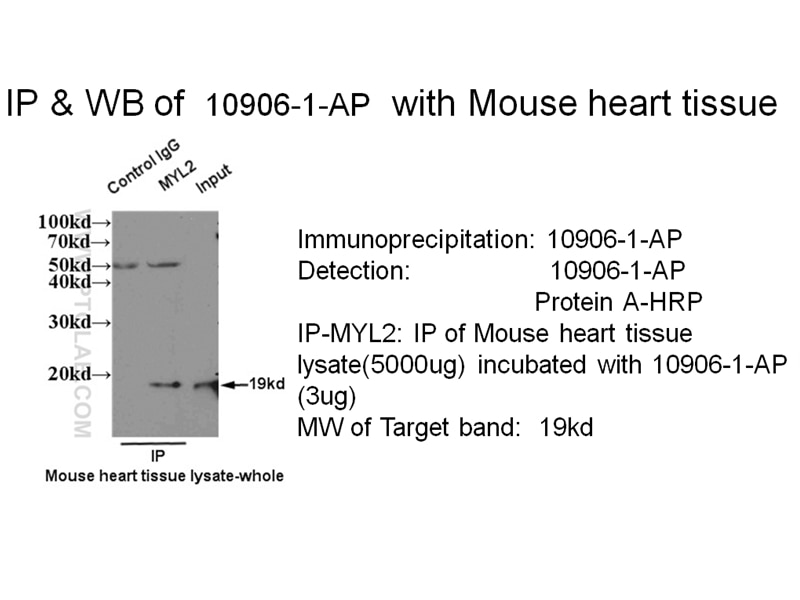 Myosin Light Chain 2/MLC-2V