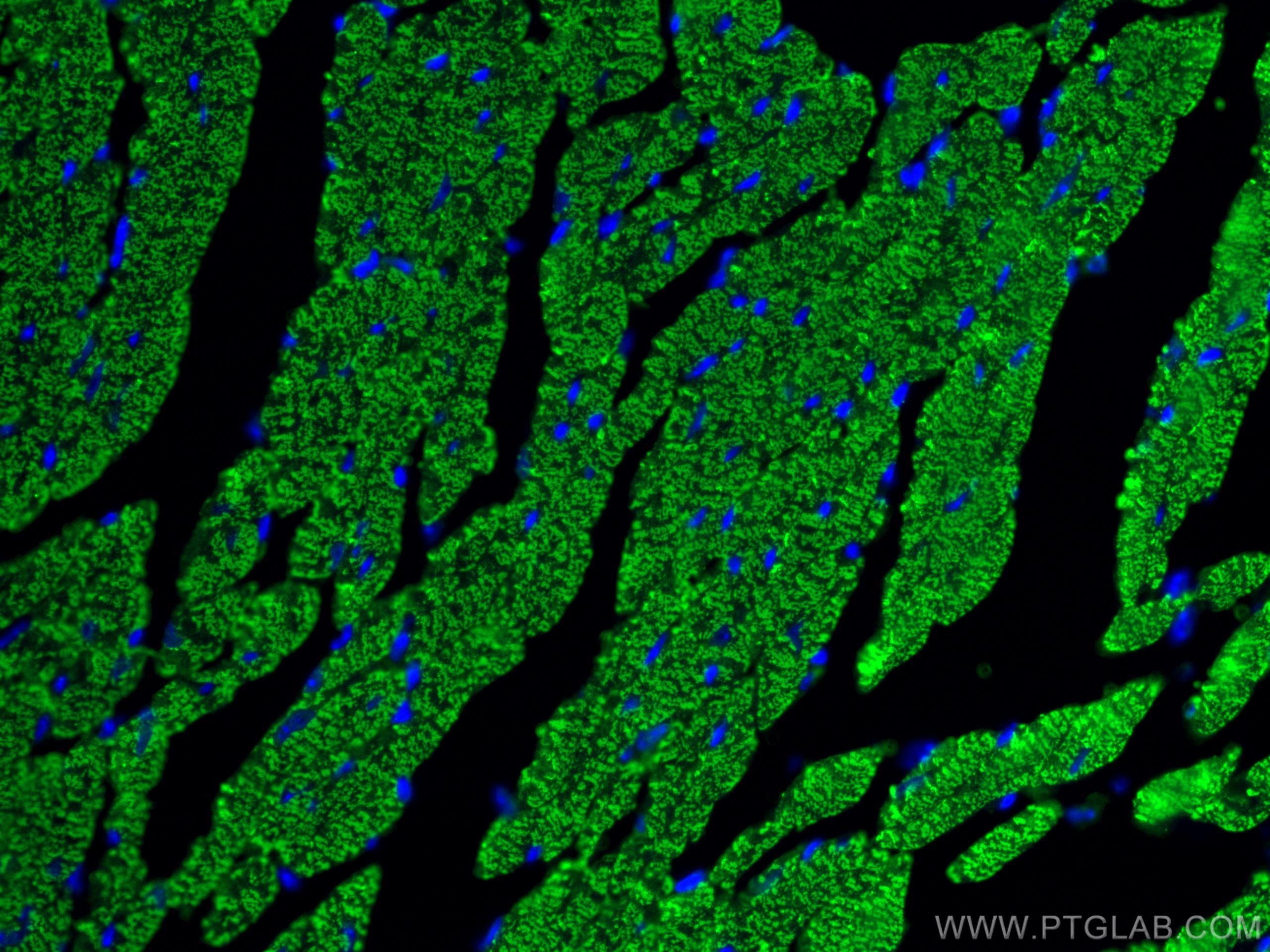 Myosin Light Chain 2/MLC-2V