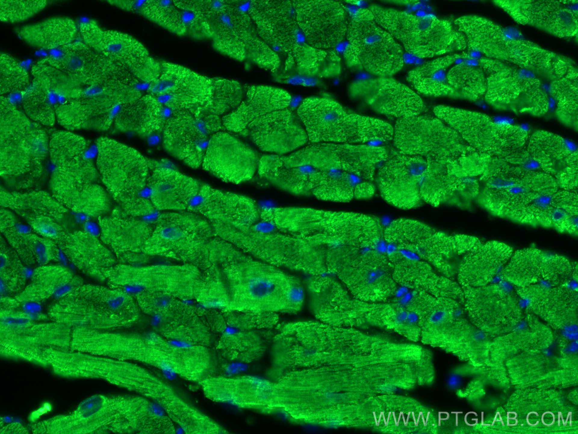 Immunofluorescence (IF) / fluorescent staining of mouse heart tissue using Myosin Light Chain 2/MLC-2V Polyclonal antibody (10906-1-AP)