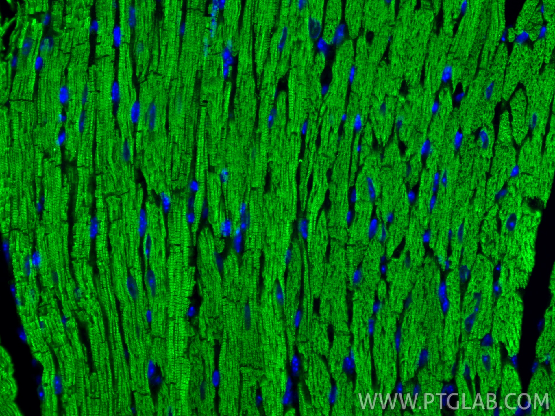 Immunofluorescence (IF) / fluorescent staining of mouse heart tissue using Myosin Light Chain 2/MLC-2V Polyclonal antibody (10906-1-AP)