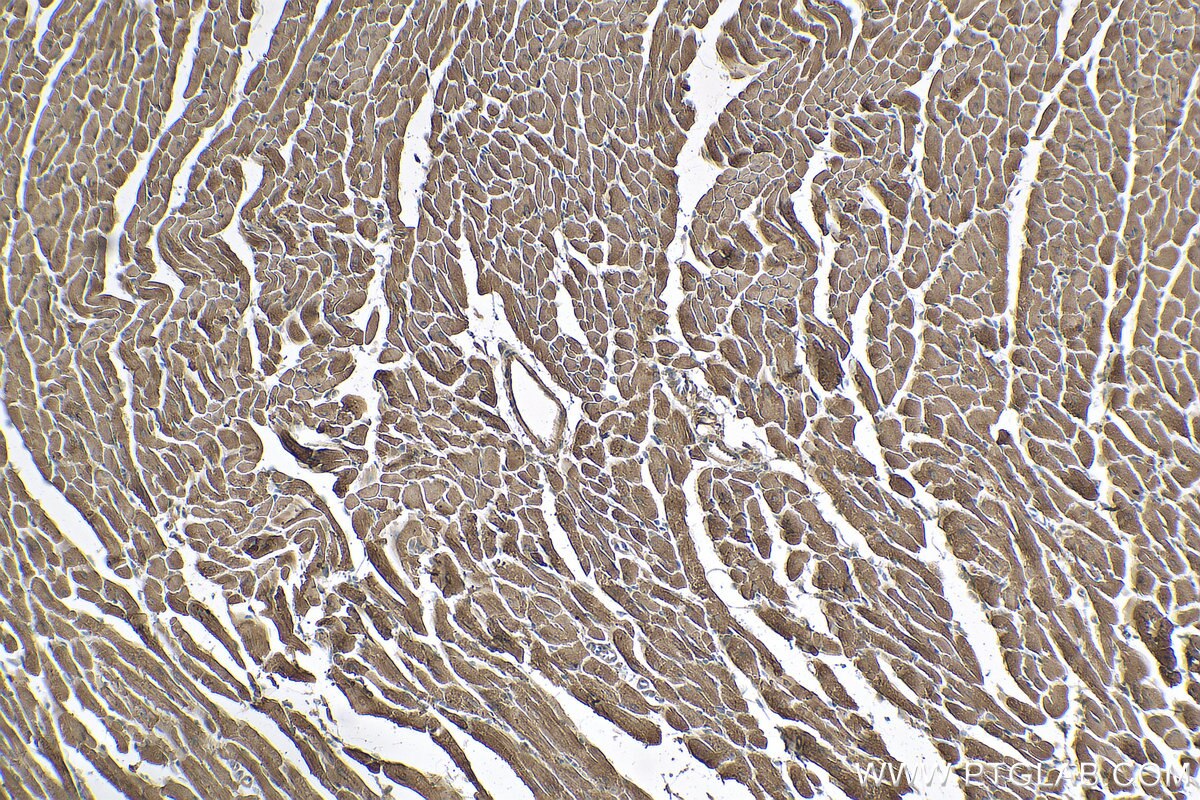 Immunohistochemistry (IHC) staining of mouse heart tissue using Myosin Light Chain 2/MLC-2V Polyclonal antibody (10906-1-AP)