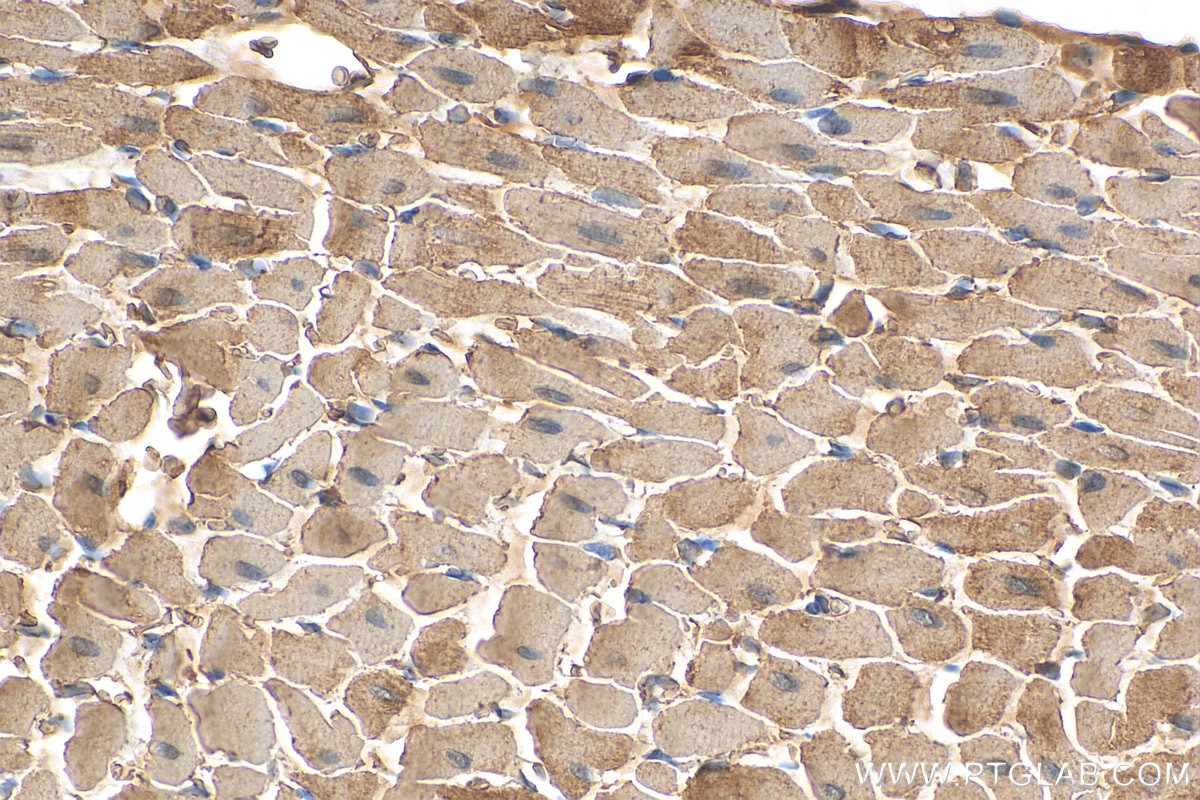 Immunohistochemistry (IHC) staining of rat heart tissue using Myosin Light Chain 2/MLC-2V Polyclonal antibody (10906-1-AP)