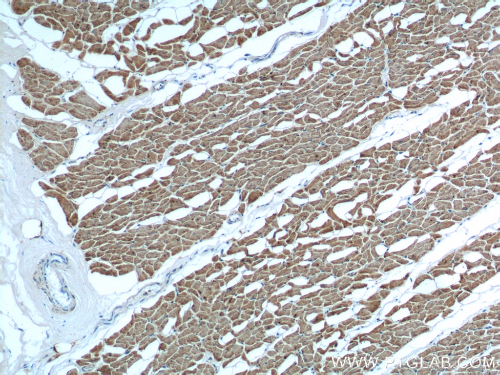 Immunohistochemistry (IHC) staining of human heart tissue using Myosin Light Chain 2/MLC-2V Polyclonal antibody (10906-1-AP)