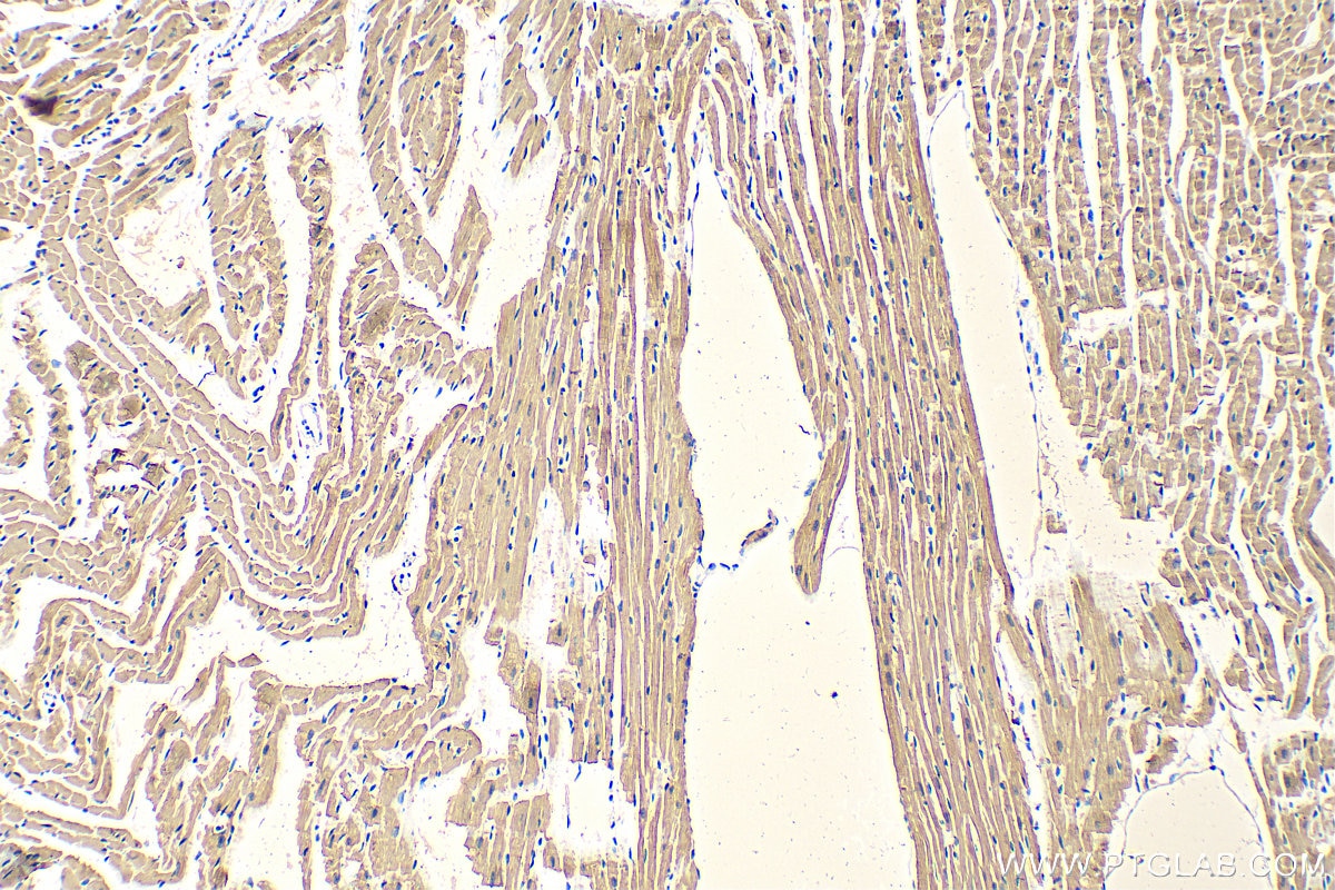 Immunohistochemistry (IHC) staining of mouse heart tissue using Myosin Light Chain 2/MLC-2V Polyclonal antibody (10906-1-AP)