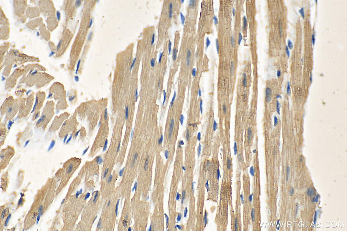Immunohistochemistry (IHC) staining of mouse heart tissue using Myosin Light Chain 2/MLC-2V Polyclonal antibody (10906-1-AP)