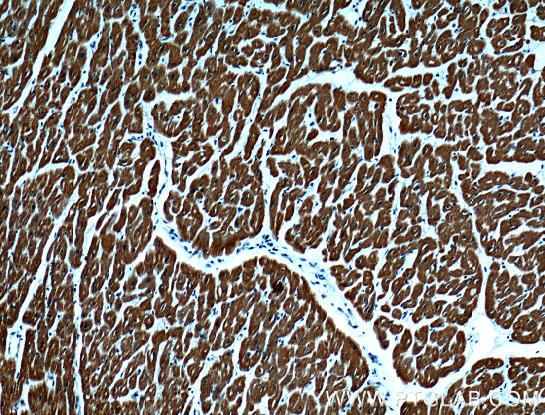 Immunohistochemistry (IHC) staining of human heart tissue using Myosin Light Chain 2/MLC-2V Polyclonal antibody (10906-1-AP)