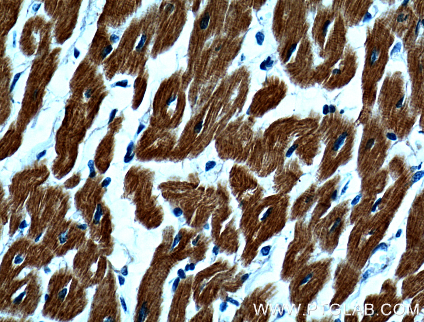 Immunohistochemistry (IHC) staining of human heart tissue using Myosin Light Chain 2/MLC-2V Polyclonal antibody (10906-1-AP)