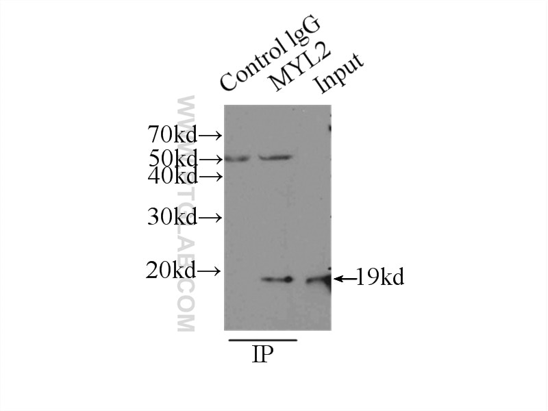 Immunoprecipitation (IP) experiment of mouse heart tissue using Myosin Light Chain 2/MLC-2V Polyclonal antibody (10906-1-AP)