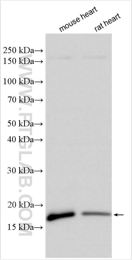 Western Blot (WB) analysis of various lysates using Myosin Light Chain 2/MLC-2V Polyclonal antibody (10906-1-AP)