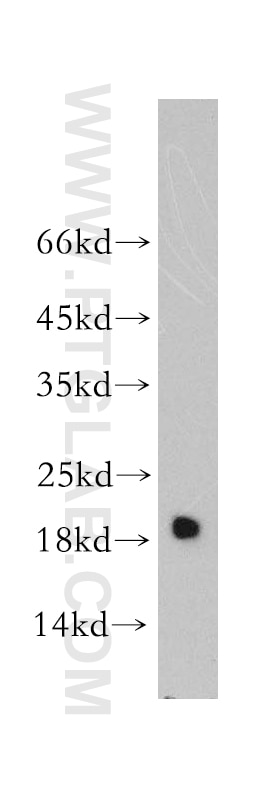 Myosin Light Chain 2/MLC-2V Polyclonal antibody