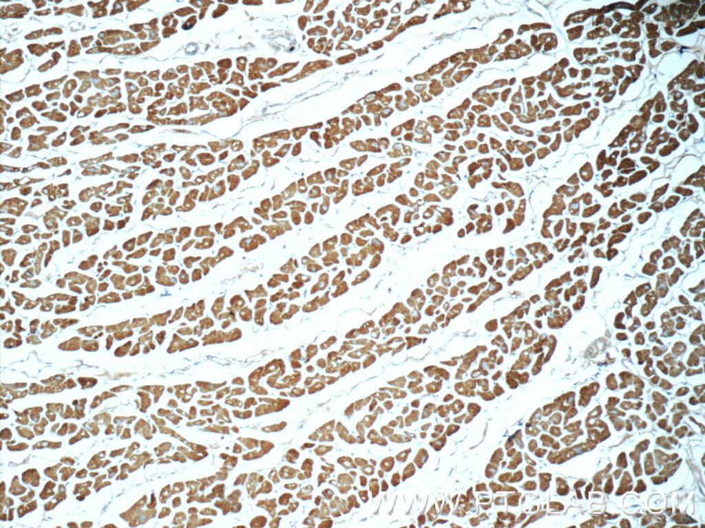 Immunohistochemistry (IHC) staining of human heart tissue using Myosin Light Chain 2/MLC-2V Polyclonal antibody (55462-1-AP)
