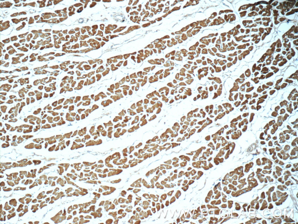 Myosin Light Chain 2/MLC-2V Polyclonal antibody