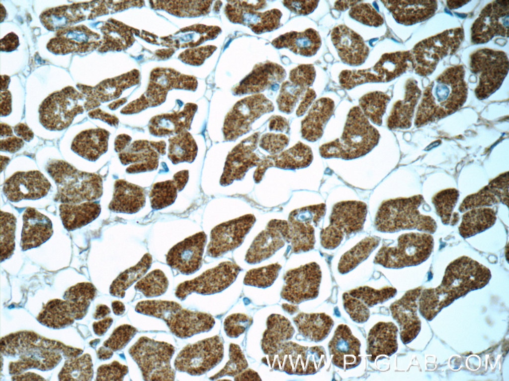 Immunohistochemistry (IHC) staining of human heart tissue using Myosin Light Chain 2/MLC-2V Polyclonal antibody (55462-1-AP)
