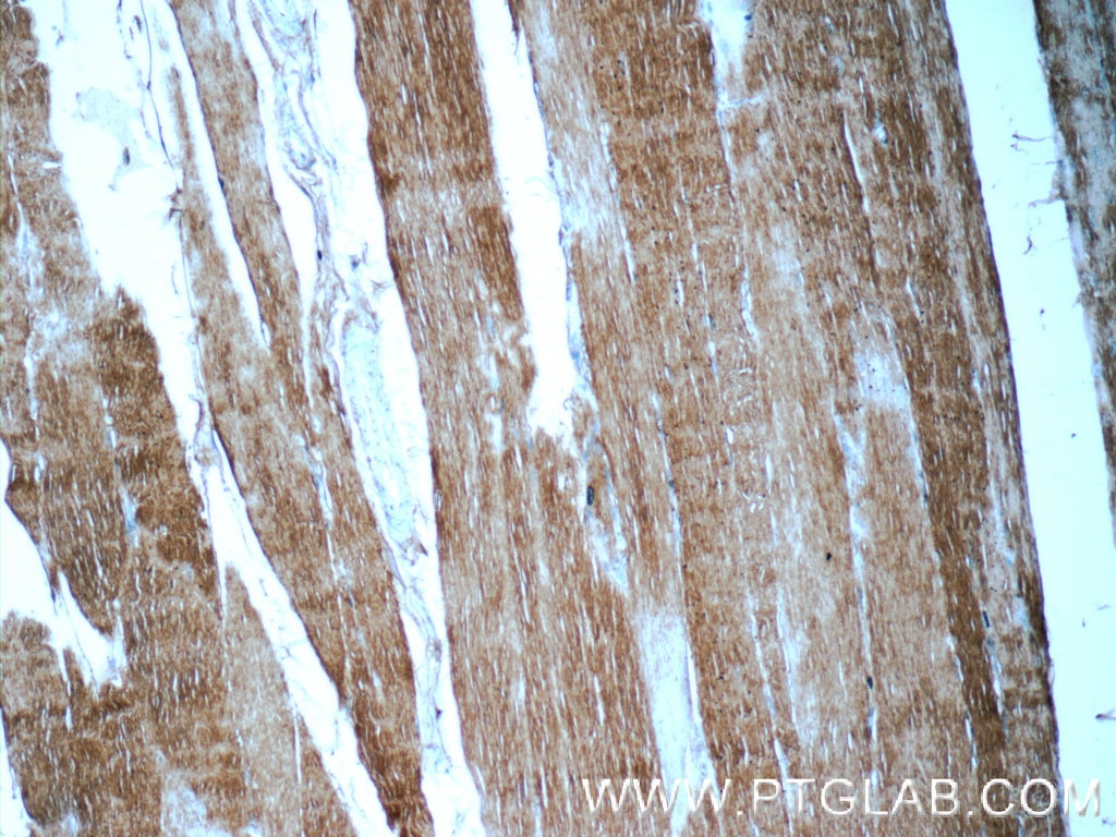 Immunohistochemistry (IHC) staining of human skeletal muscle tissue using Myosin Light Chain 2/MLC-2V Polyclonal antibody (55462-1-AP)