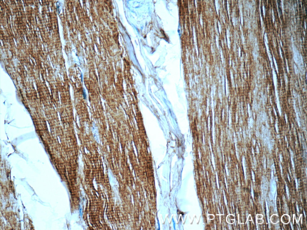 Immunohistochemistry (IHC) staining of human skeletal muscle tissue using Myosin Light Chain 2/MLC-2V Polyclonal antibody (55462-1-AP)