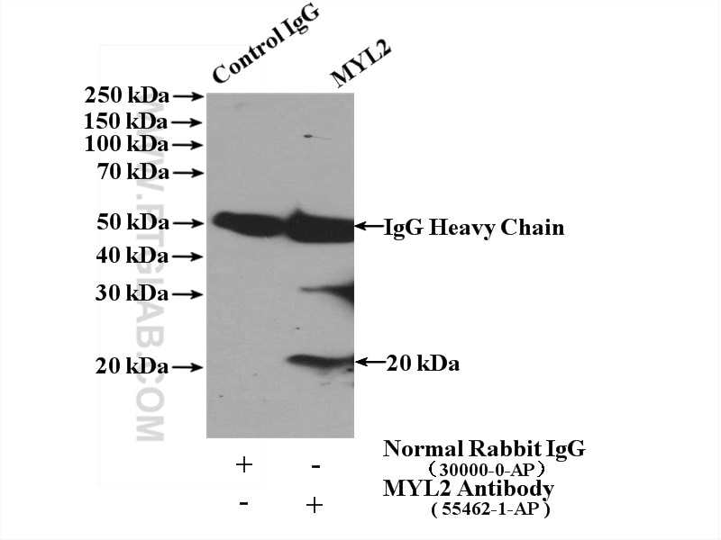 Immunoprecipitation (IP) experiment of mouse brain tissue using Myosin Light Chain 2/MLC-2V Polyclonal antibody (55462-1-AP)