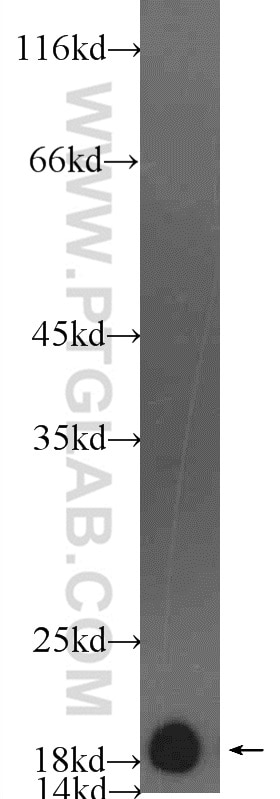 Western Blot (WB) analysis of rat heart tissue using Myosin Light Chain 2/MLC-2V Polyclonal antibody (55462-1-AP)