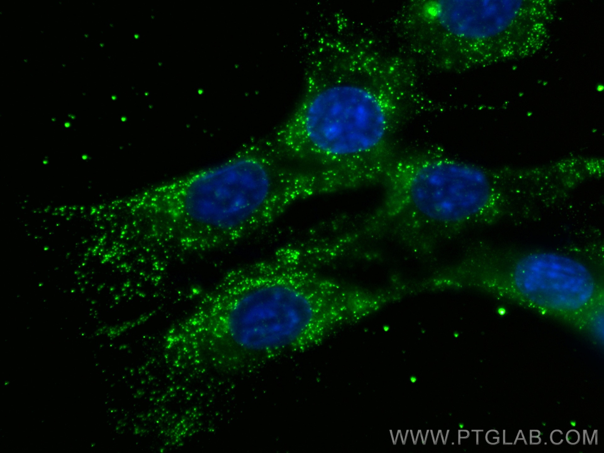 Immunofluorescence (IF) / fluorescent staining of C2C12 cells using Myosin Light Chain 2/MLC-2V Monoclonal antibody (60229-1-Ig)