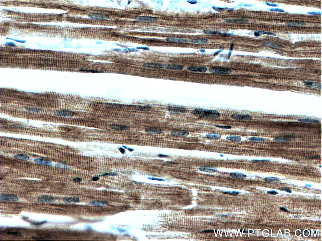 Immunohistochemistry (IHC) staining of human heart tissue using Myosin Light Chain 2/MLC-2V Monoclonal antibody (60229-1-Ig)