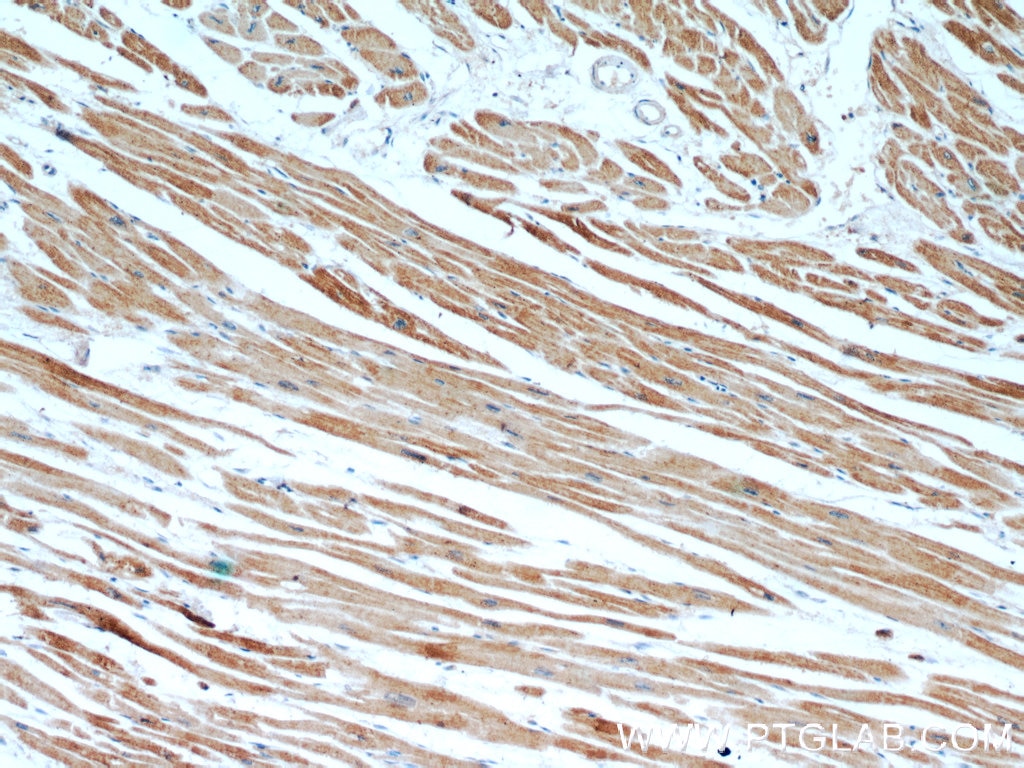 Myosin Light Chain 2/MLC-2V