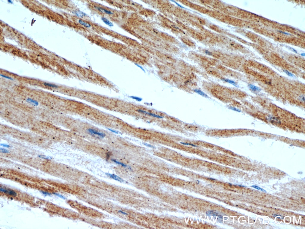 Myosin Light Chain 2/MLC-2V Monoclonal antibody