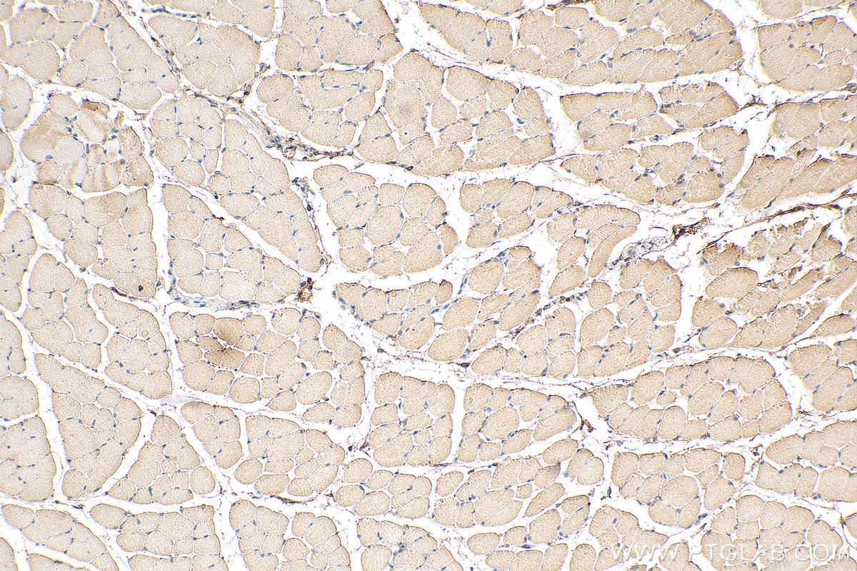 Immunohistochemistry (IHC) staining of mouse skeletal muscle tissue using Myosin Light Chain 2/MLC-2V Monoclonal antibody (60229-1-Ig)