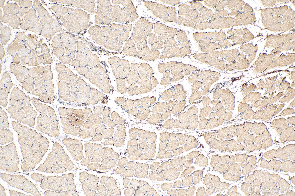 IHC staining of mouse skeletal muscle using 60229-1-Ig