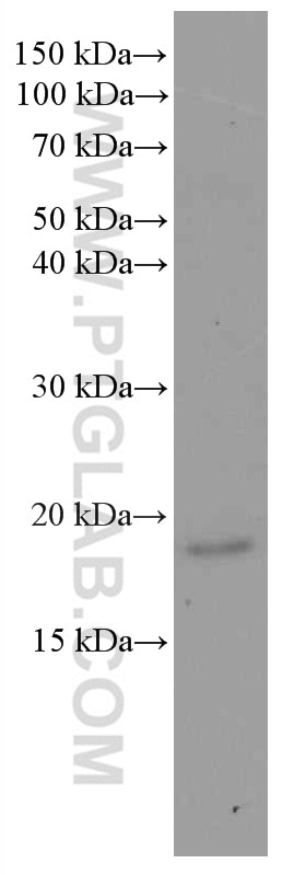 Western Blot (WB) analysis of pig heart tissue using Myosin Light Chain 2/MLC-2V Monoclonal antibody (60229-1-Ig)