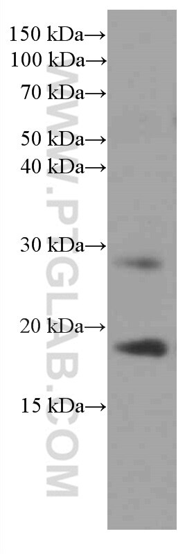 Western Blot (WB) analysis of rat heart tissue using Myosin Light Chain 2/MLC-2V Monoclonal antibody (60229-1-Ig)