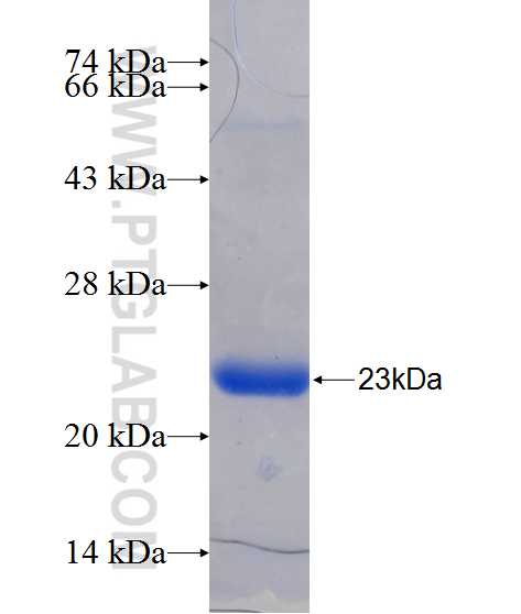 MYL2 fusion protein Ag21798 SDS-PAGE