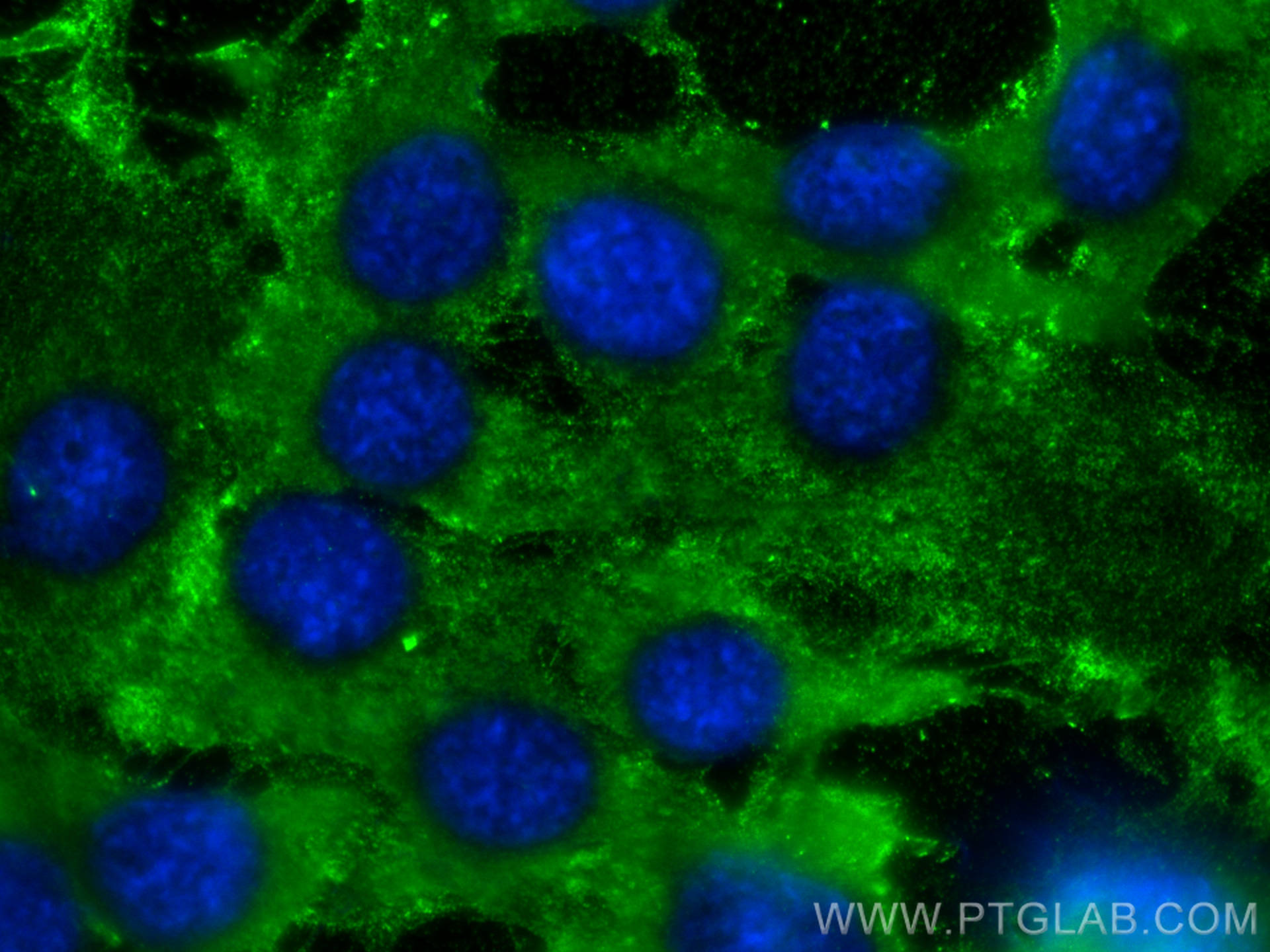 Immunofluorescence (IF) / fluorescent staining of C2C12 cells using MYL3 Polyclonal antibody (10913-1-AP)