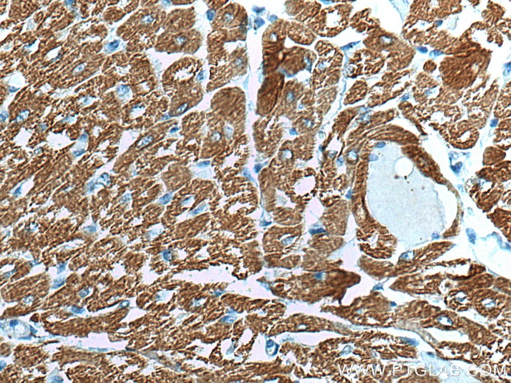 Immunohistochemistry (IHC) staining of human heart tissue using MYL3 Polyclonal antibody (10913-1-AP)