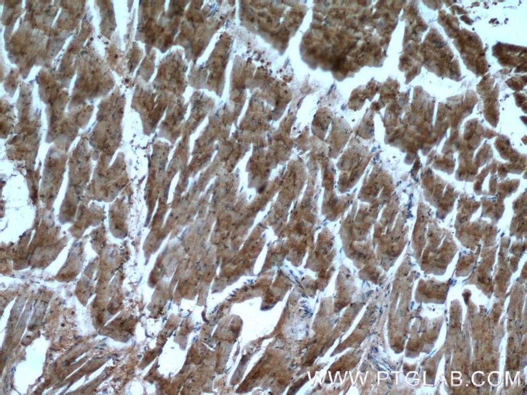 MYL3 Polyclonal antibody