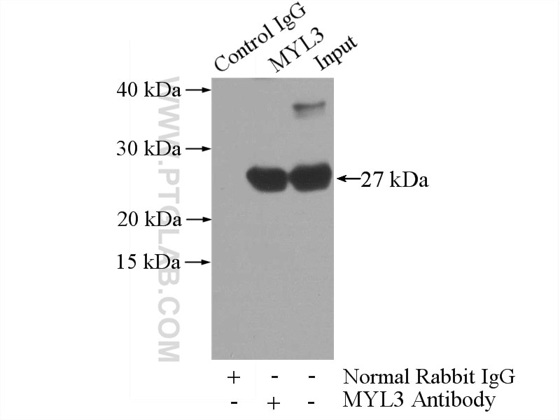 Immunoprecipitation (IP) experiment of mouse heart tissue using MYL3 Polyclonal antibody (10913-1-AP)